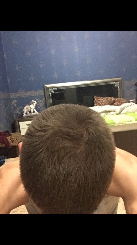 Волосы форум мужчины